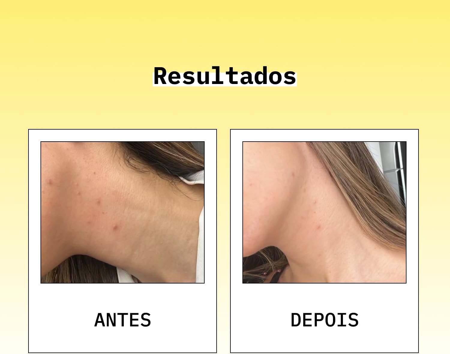 Imagem lateral do produto, com fundo amarelo degradê e área branca nas fotos individuais. Imagem lateral do produto, com fundo amarelo degradê e área branca nas fotos individuais.